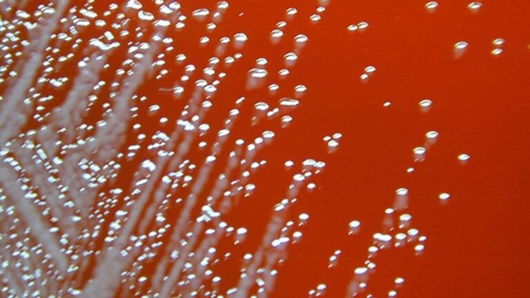 Two men fell gravely ill last year; their infections link to deaths in the ’80s