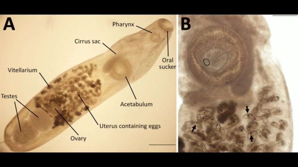 Woman Visits the Galápagos and All She Got Was This Exotic Eye Parasite Woman Visits the Galápagos and All She Got Was This Exotic Eye Parasite